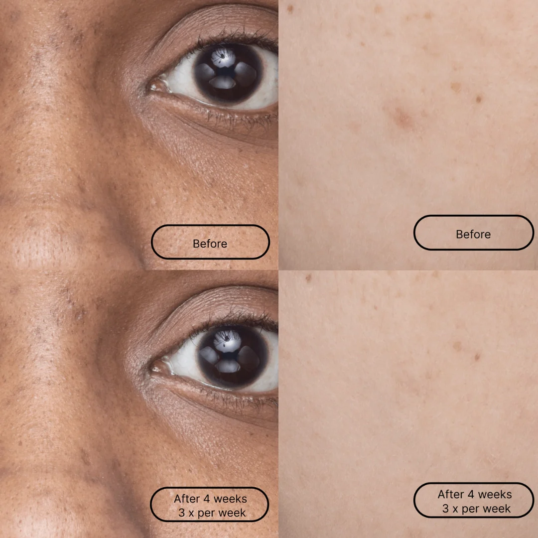 dark spot single mask - Image 3